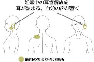 耳管開放症症例 浜松の鍼灸院 首から上の症状専門 浜松の鍼灸院 首から上の症状専門